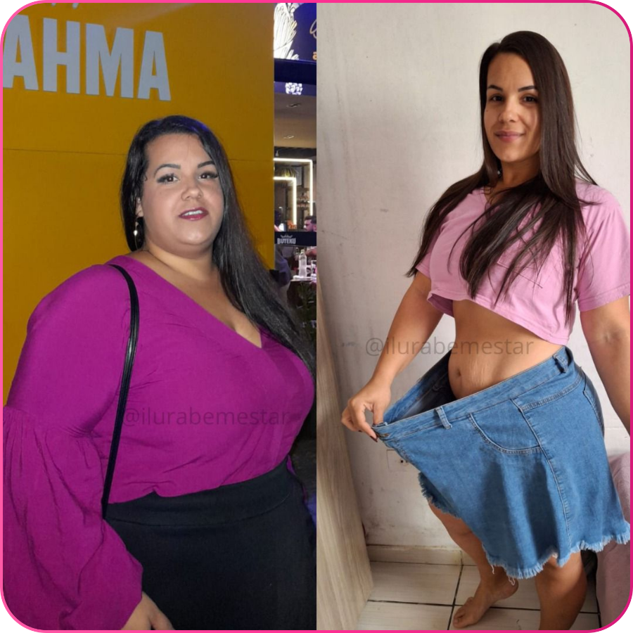 Antes e depois — transformação real 1