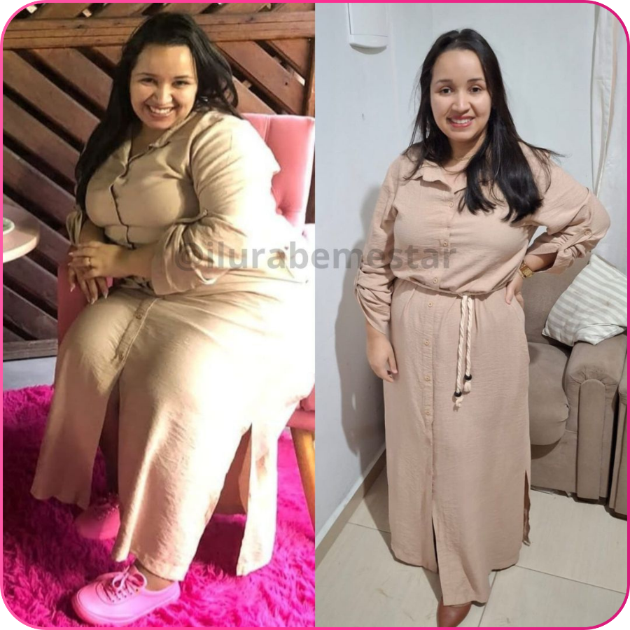 Antes e depois — transformação real 2