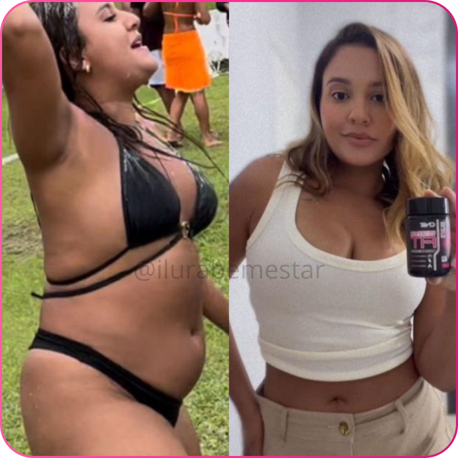 Antes e depois — transformação real 3