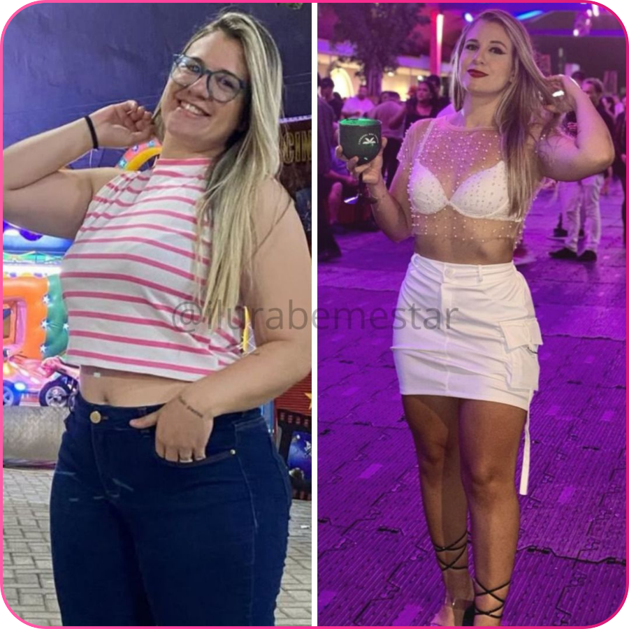 Antes e depois — transformação real 5