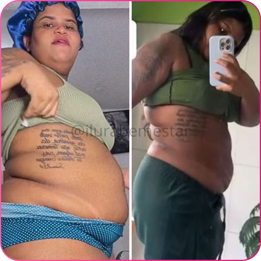 Antes e depois — transformação real 6