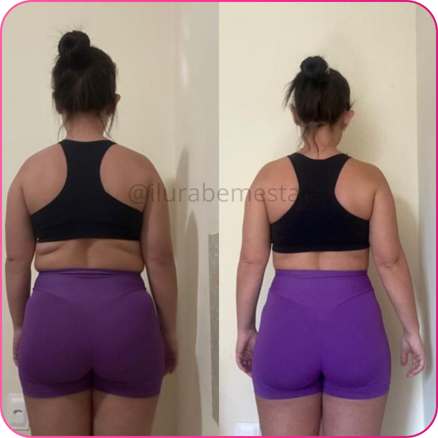Antes e depois — transformação real 7