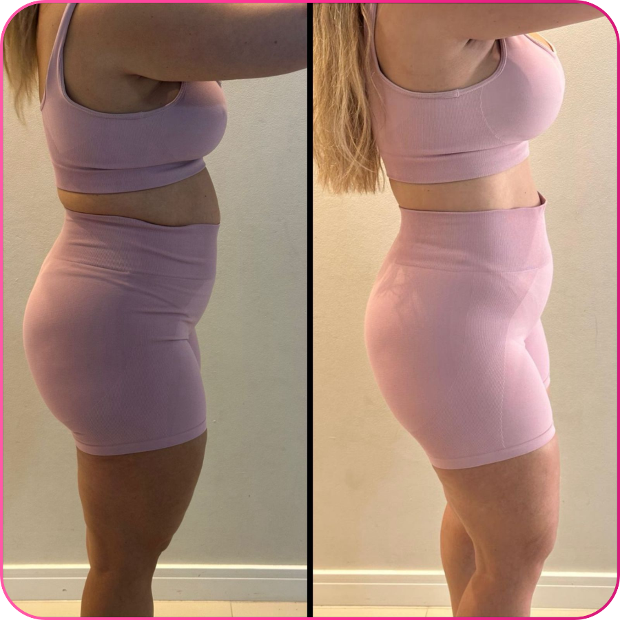 Antes e depois — transformação real 8