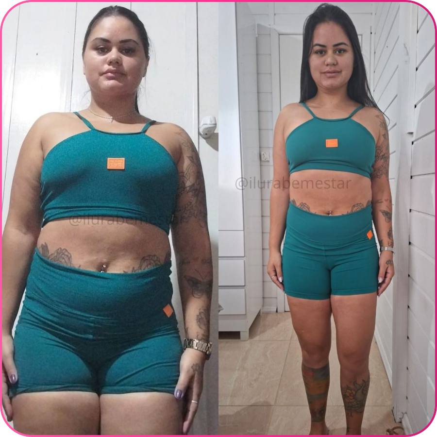 Antes e depois — transformação real 10