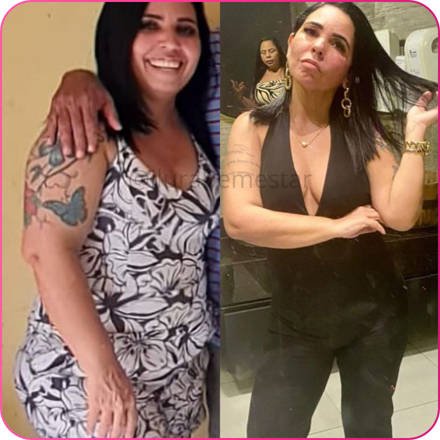 Antes e depois — transformação real 11